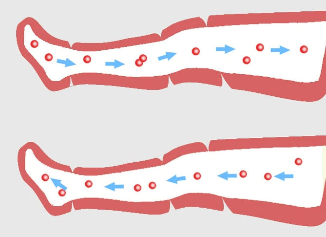 Presoterapinis limfodrenažinis kūno masažuoklis, 360° masažas, 6 kameros